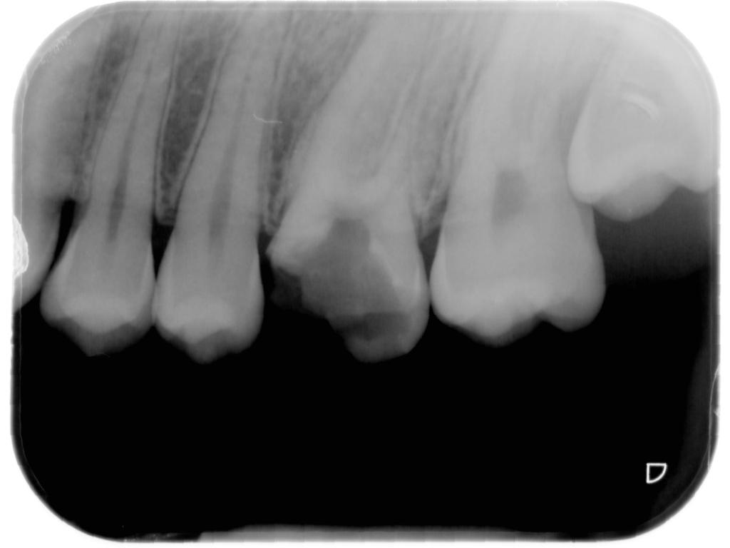 endodonzia Monza